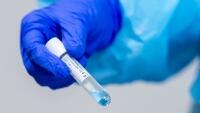 covid testovaniucetlu2